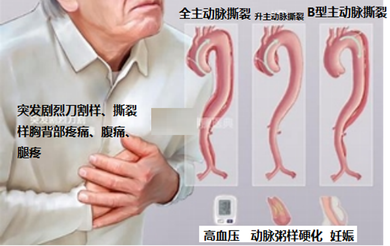 图片 2