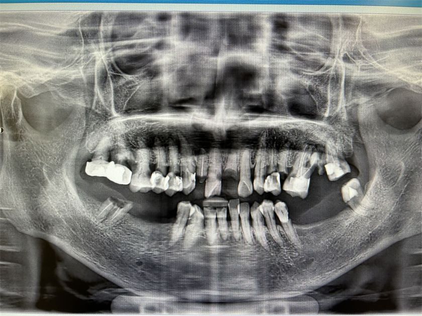 img_v3_02ac_7f932fae-094a-4ddb-95d4-025015927f4g