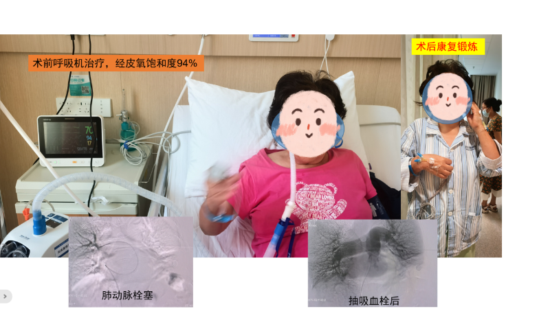 图片 1