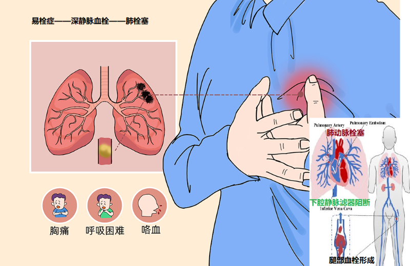 图片 3