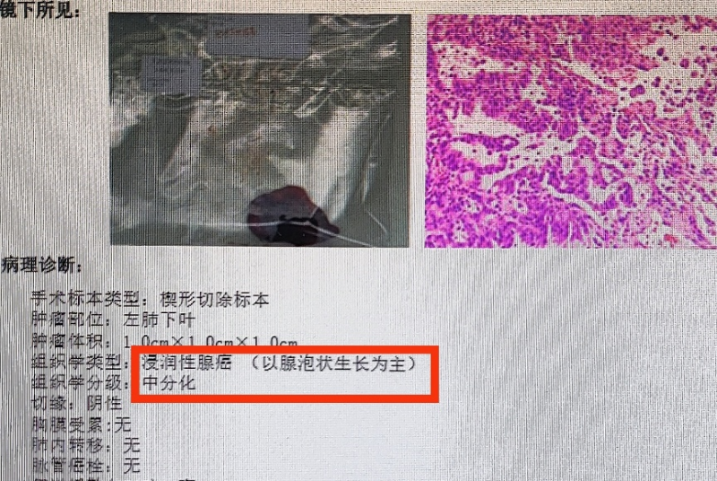 图片 7