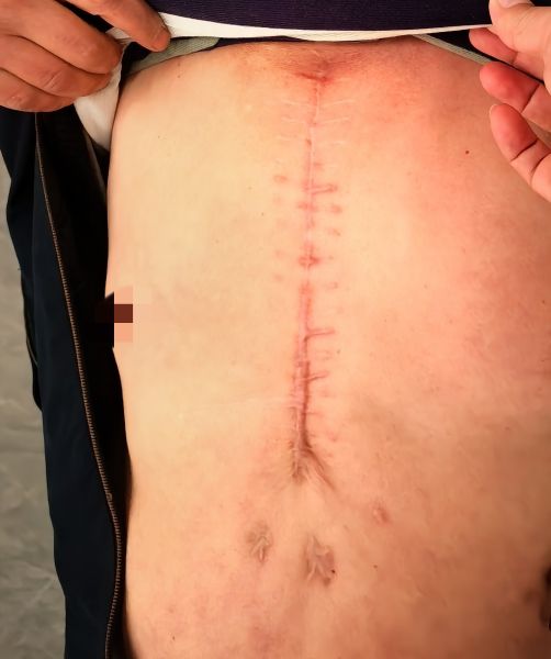 img_v3_02i5_8b49fa1e-7950-43a1-bb89-a893c2cbc76g