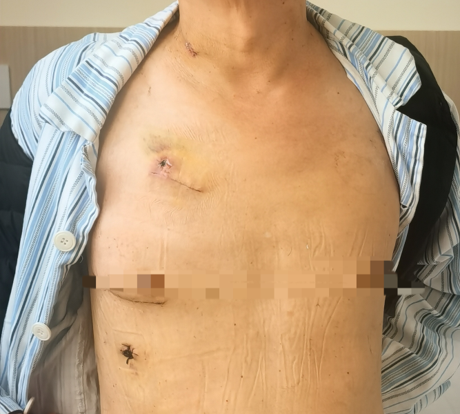 img_v3_02i5_b351da43-b081-485f-98c7-ff615a3f2a4g