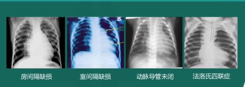 图片 6