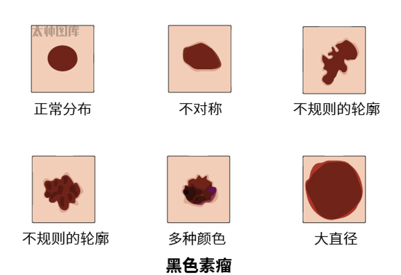 图片 4