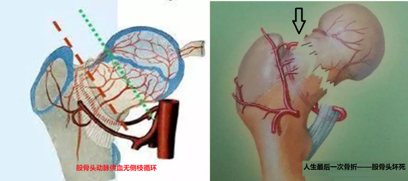 图片 2