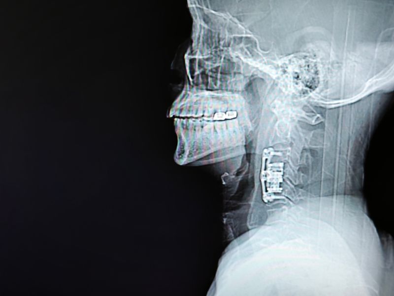 fea48ce4dcc66675345adc66dec0e20e